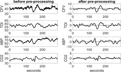 The Dynamic Relationship Between Cortical Oxygenation and End-Tidal CO2 Transient Changes Is Impaired in Mild Cognitive Impairment Patients